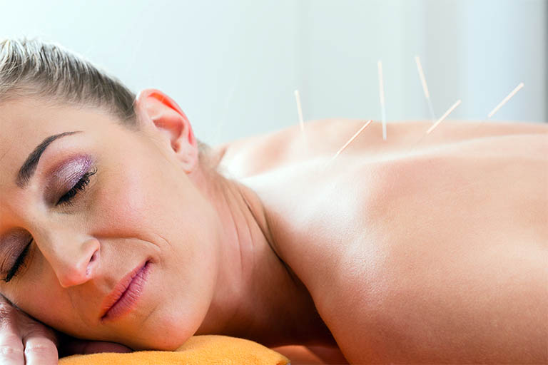 woman relaxing during Acupuncture in Carter Lake, Council Bluffs, Neola, Treynor, and Underwood